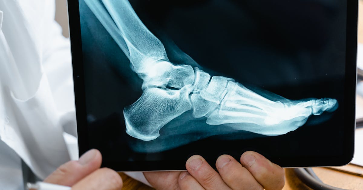 Le guide complet sur la chirurgie bariatrique : tout ce qu’il faut savoir