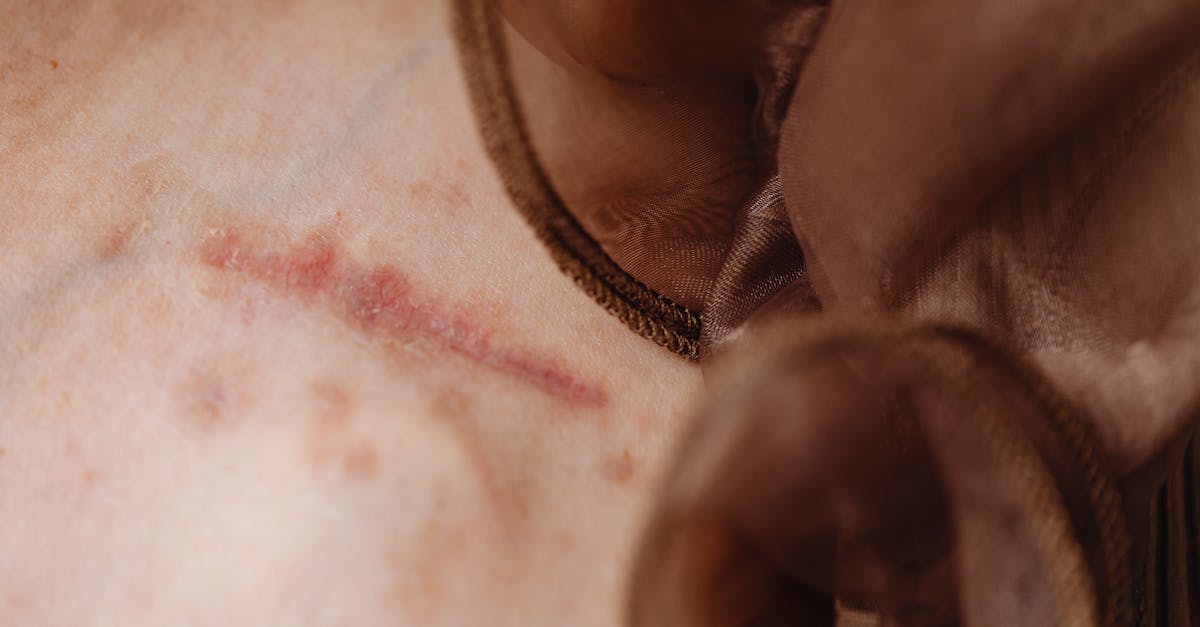 découvrez la beauté des imperfections à travers notre exploration des défauts qui rendent chaque individu unique. apprenez à embrasser ce qui vous rend authentique et à célébrer la diversité sous toutes ses formes.